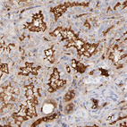 Immunohistochemical staining of human kidney shows strong extracellular space positivity in cells in tubules.