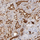 Immunohistochemical staining of human kidney shows strong extracellular space positivity in cells in tubules.