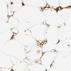Immunohistochemical staining of human adipose tissue shows strong extracellular space positivity in adipocytes.