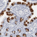 Immunohistochemical staining of human small intestine shows strong positivity in mucus in goblet cells.