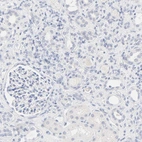 Immunohistochemical staining of human kidney shows low positivity in cells in tubules as expected.