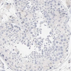 Immunohistochemical staining of human testis shows low positivity in cells in seminiferous ducts as expected.