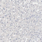Immunohistochemical staining of human liver shows low positivity in hepatocytes as expected.