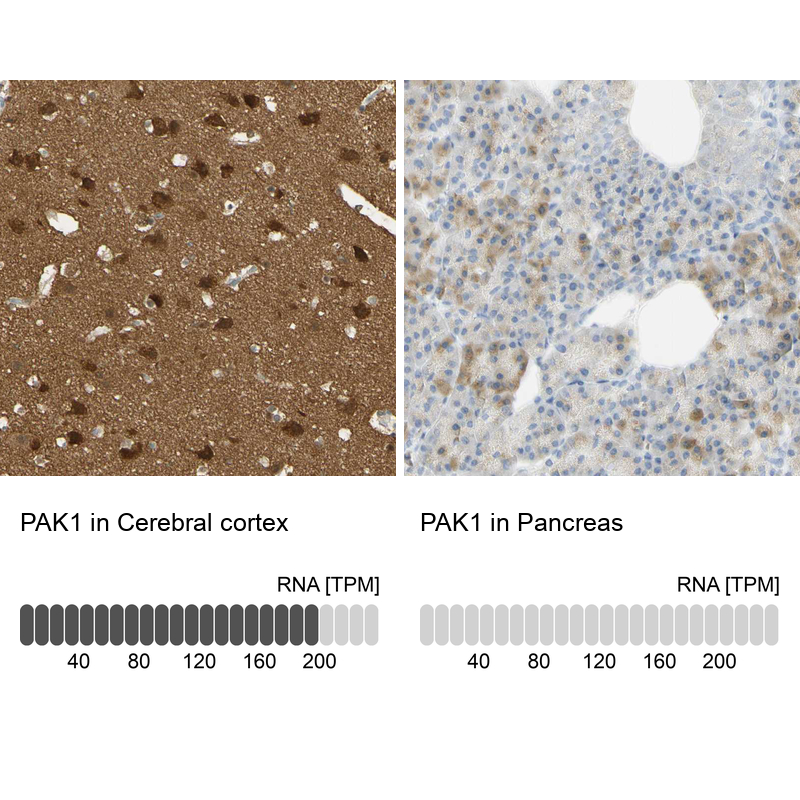 Anti-PAK1 Antibody
