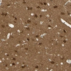 Immunohistochemical staining of human cerebral cortex shows strong cytoplasmic positivity in neurons.
