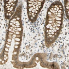Immunohistochemical staining of human rectum shows strong cytoplasmic ad membranous positivity in glandular cells.