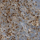 Immunohistochemical staining of human lymph node shows moderate cytoplasmic positivity in non-germinal center cells.