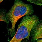 Immunofluorescent staining of human cell line U-2 OS shows localization to plasma membrane & cytosol.