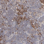 Anti-RPS20 Antibody