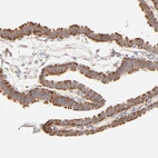 Immunohistochemical staining of human fallopian tube shows moderate positivity in glandular cells.