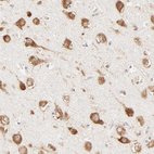 Anti-RPS20 Antibody