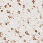Immunohistochemical staining of human cerebral cortex shows moderate cytoplasmic positivity in neuronal cells.