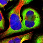 Immunofluorescent staining of human cell line U-2 OS shows localization to cytosol & endoplasmic reticulum.