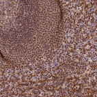 Anti-TRIM22 Antibody