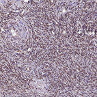 Anti-TRIM22 Antibody