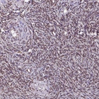 Immunohistochemical staining of human Ovary shows strong nuclear positivity in ovarian stromal cells.