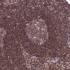 Immunohistochemical staining of human Lymph node shows strong nuclear and cytoplasmic positivity in germinal center and non-germinal center cells.
