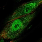 Immunofluorescent staining of human cell line ASC TERT1 shows localization to nucleoplasm, nuclear bodies & the Golgi apparatus.