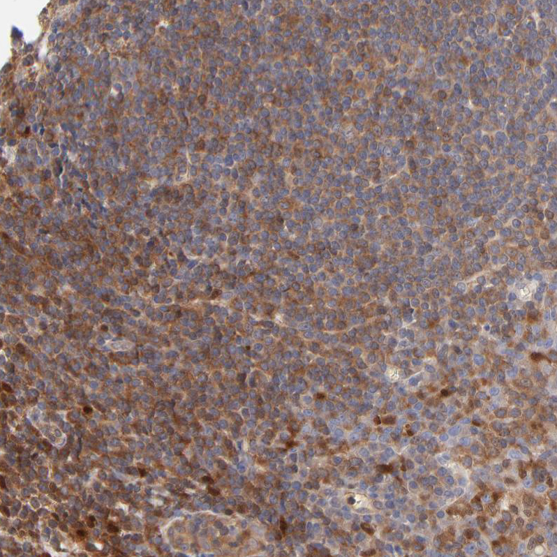 Anti-ARHGEF6 Antibody