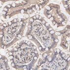 Anti-ARHGEF6 Antibody