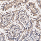 Immunohistochemical staining of human small intestine shows weak cytoplasmic positivity in glandular cells.