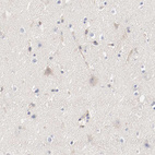 Anti-ARHGEF6 Antibody