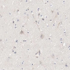 Immunohistochemical staining of human cerebral cortex shows very weak cytoplasmic positivity in neurons.