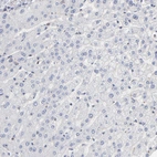 Immunohistochemical staining of human liver shows no positivity in hepatocytes as expected.