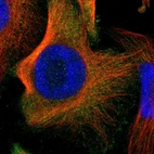 Immunofluorescent staining of human cell line U-251 MG shows localization to cytosol.