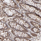 Immunohistochemical staining of human rectum shows moderate cytoplasmic positivity in glandular cells.