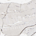 Immunohistochemical staining of human skeletal muscle shows no positivity in myocytes as expected.