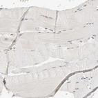 Immunohistochemical staining of human skeletal muscle shows no positivity in myocytes as expected.