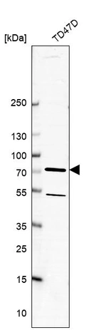 Western blot analysis in human cell line TD47D.