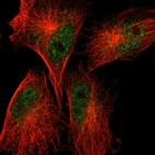 Immunofluorescent staining of human cell line U-251 MG shows localization to nucleoplasm & cytosol.