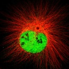 Anti-DCAF11 Antibody