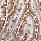 Anti-PARP12 Antibody
