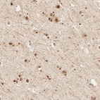 Immunohistochemical staining of human cerebral cortex strong nuclear/cytoplasmic positivity in neurons.