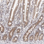 Anti-VIPAS39 Antibody