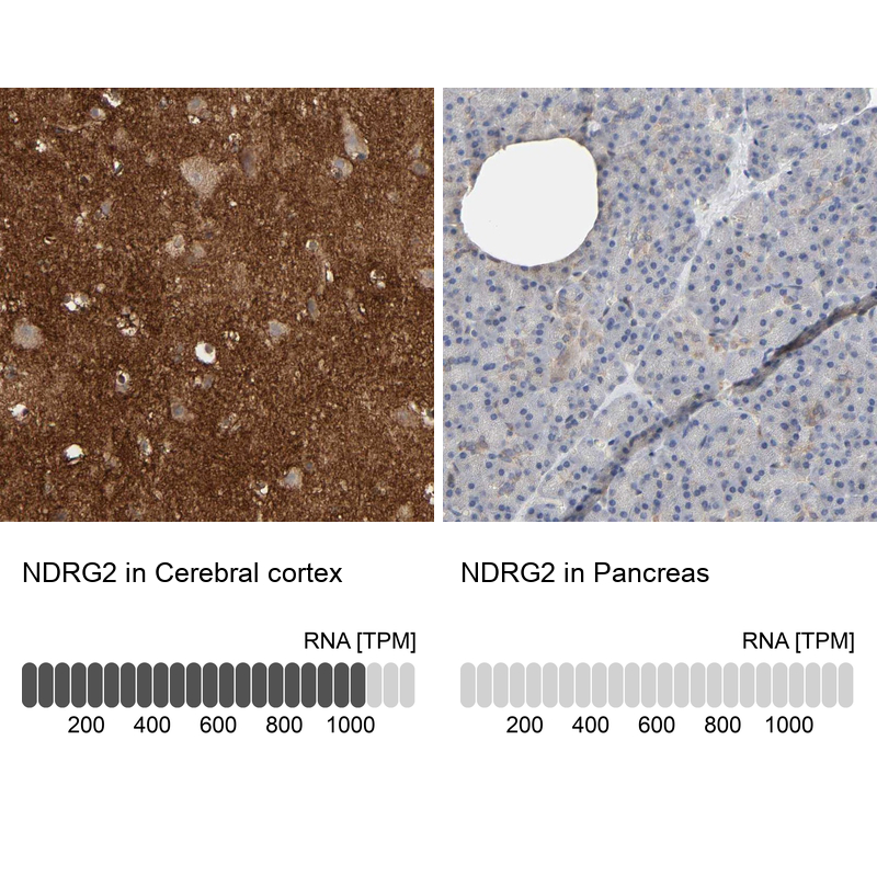 Anti-NDRG2 Antibody