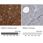 Anti-NDRG2 Antibody
