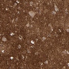 Anti-NDRG2 Antibody