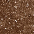 Immunohistochemical staining of human cerebral cortex shows high expression.