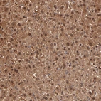 Immunohistochemical staining of human liver shows strong cytoplasmic and nuclear positivity in hepatocytes.