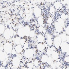 Anti-ARG1 Antibody