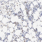 Immunohistochemical staining of human bone marrow shows strong cytoplasmic and nuclear positivity in a subset of hematopoietic cells.