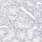 Immunohistochemical staining of human kidney shows no positivity in cells in tubules as expected.