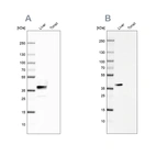 Western blot analysis using Anti-ARG1 antibody HPA003595 (A) shows similar pattern to independent antibody HPA024006 (B).