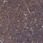 Anti-MAPRE1 Antibody