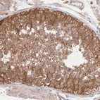 Immunohistochemical staining of human testis shows strong cytoplasmic positivity in cells in seminiferous ducts.