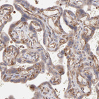 Immunohistochemical staining of human placenta shows moderate cytoplasmic positivity in trophoblastic cells.